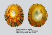 Patella vulgata